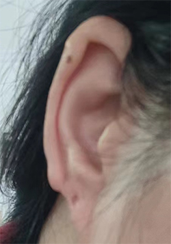 耳朵特征.jpg