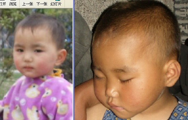 杭州拍到一个两岁多的宝宝（头顶有伤疤